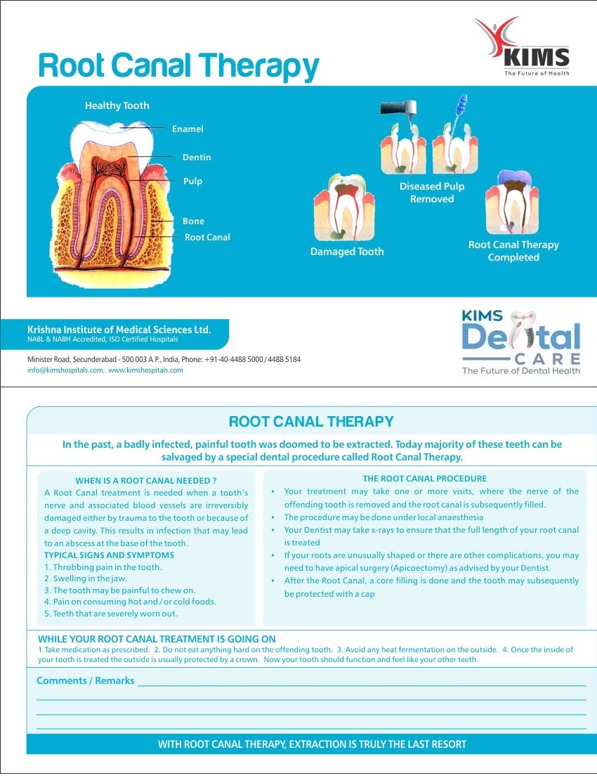 Root canal therapy