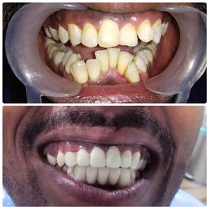 Kims dental hospital and responsible in dental hospital Kondapur I am recommand to this clinic