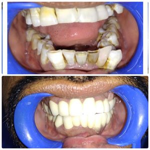 kims staff is best in Kondapur, Hyderabad India, Best Dental Clinic In kondapur also