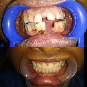 Kims dental hospital is Best Dental Clinic In kondapur and Great Dentist in India