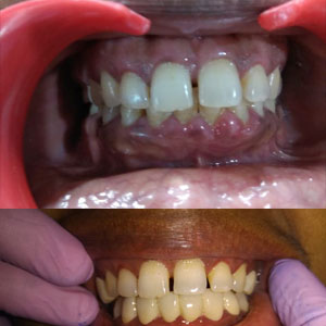 no.1 treatment proving in kims detal care