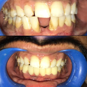 best dental clinic in Kondapur in India