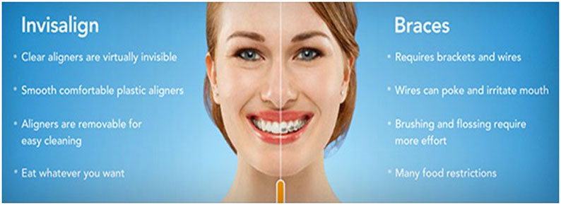 Kims dental hospital, best dental care, dental clinic Kondapur, dental implants Kondapur, dentist Kondapur, dentist in Kondapur, dental appointment in Kondapur, dental hospital Kondapur, best dental in India, best dental hospital in Hyderabad, best dental hospital in secundrabad