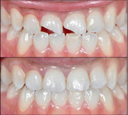 Kims dental hospital, best dental care, dental clinic Kondapur, dental implants Kondapur, dentist Kondapur, dentist in Kondapur, dental appointment in Kondapur, dental hospital Kondapur, best dental in India, best dental hospital in Hyderabad, best dental hospital in secundrabad