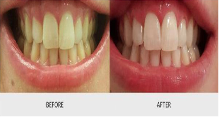 Kims dental hospital, best dental care, dental clinic Kondapur, dental implants Kondapur, dentist Kondapur, dentist in Kondapur, dental appointment in Kondapur, dental hospital Kondapur, best dental in India, best dental hospital in Hyderabad, best dental hospital in secundrabad