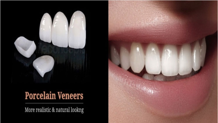 Kims dental hospital, best dental care, dental clinic Kondapur, dental implants Kondapur, dentist Kondapur, dentist in Kondapur, dental appointment in Kondapur, dental hospital Kondapur, best dental in India, best dental hospital in Hyderabad, best dental hospital in secundrabad
