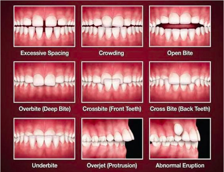 Kims dental hospital, best dental care, dental clinic Kondapur, dental implants Kondapur, dentist Kondapur, dentist in Kondapur, dental appointment in Kondapur, dental hospital Kondapur, best dental in India, best dental hospital in Hyderabad, best dental hospital in secundrabad