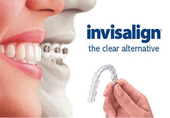 Kims dental hospital, best dental care, dental clinic Kondapur, dental implants Kondapur, dentist Kondapur, dentist in Kondapur, dental appointment in Kondapur, dental hospital Kondapur, best dental in India, best dental hospital in Hyderabad, best dental hospital in secundrabad