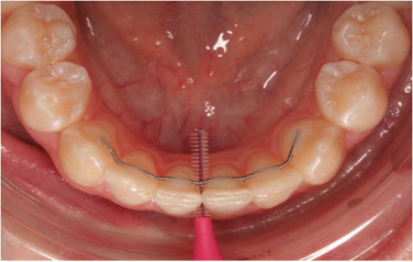 Kims dental hospital, best dental care, dental clinic Kondapur, dental implants Kondapur, dentist Kondapur, dentist in Kondapur, dental appointment in Kondapur, dental hospital Kondapur, best dental in India, best dental hospital in Hyderabad, best dental hospital in secundrabad